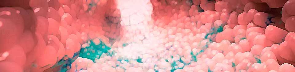 sindrome-del-Intestino-permeable