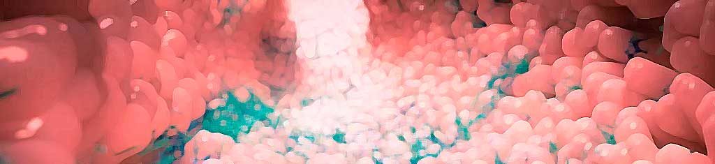 sindrome-del-Intestino-permeable